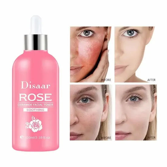 Imagen de TONIFICADOR FACIAL ROSE DS5302